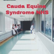 Cauda Equina Syndrome NHS