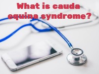 What Is Cauda Equina Syndrome?